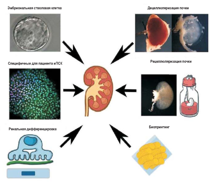 Эмбриональные стволовые клетки. Стромальные клетки почки. Стволовые клетки почки. Эмбриональная стволовая клетка.